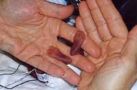 
	تصویری از &laquo;آمیلیا سونجا تایلور&raquo; کوچک ترین نوزاد جهان که در بیمارستان شهر میامی آمریکا گرفته شده.&nbsp; &nbsp;
	
	
همین پاهای کوچکند که ما را به بالاترین قله ها می رسانند.
